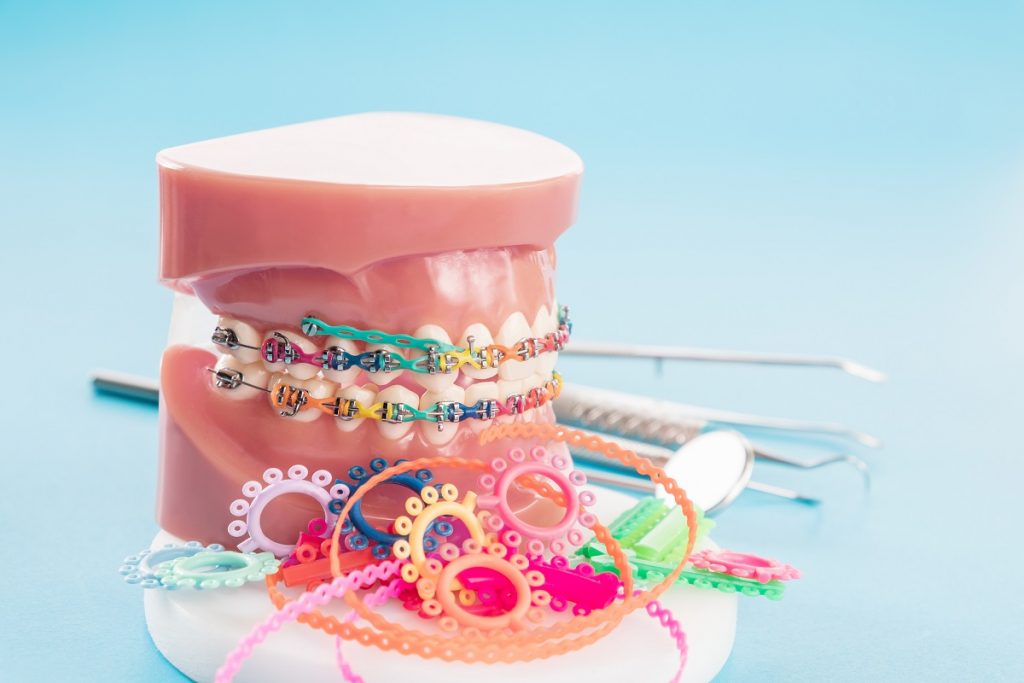 dental braces concept