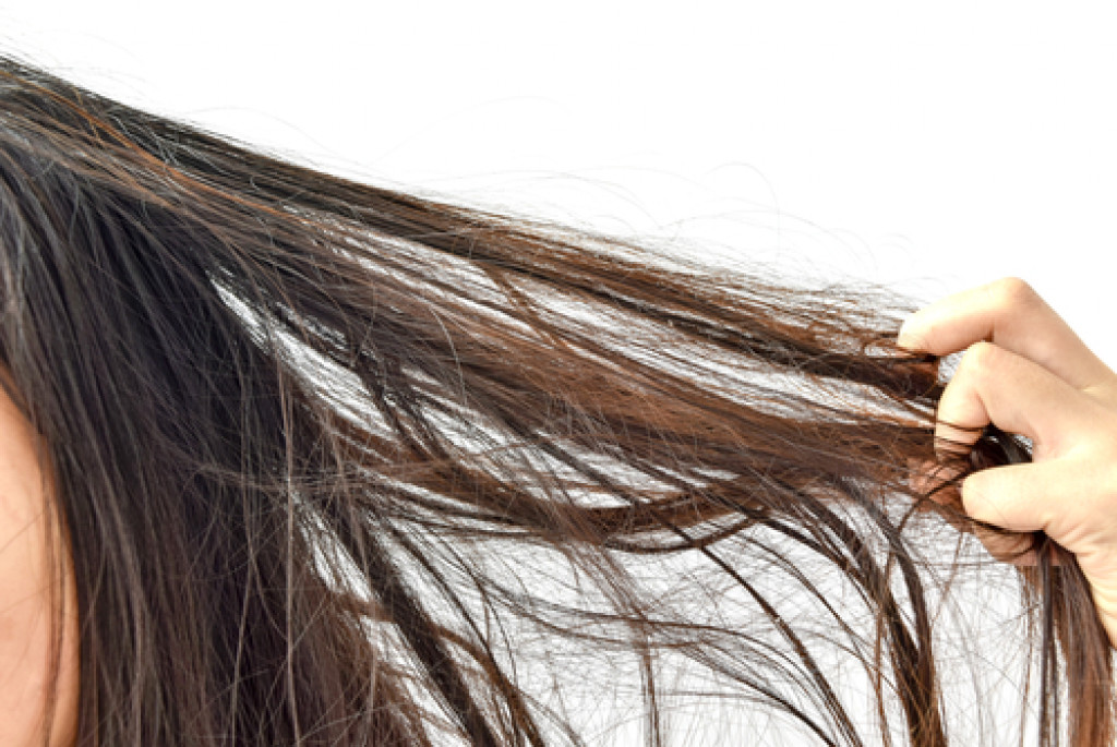 Dry hair in woman
